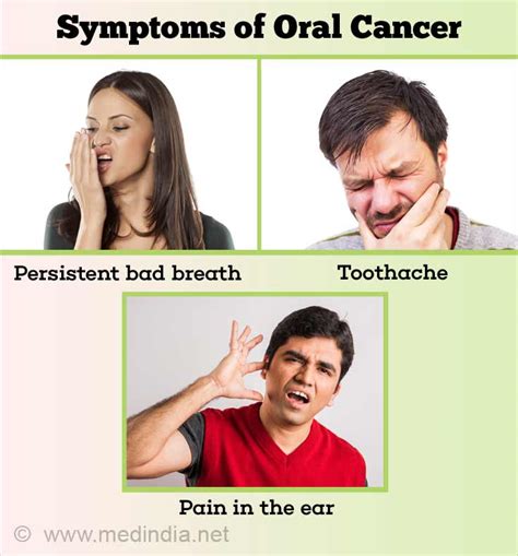 Common Oral Cancer Signs Symptoms And Ways To Prevent It Kulturaupice