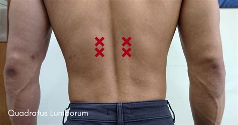 How To Identify Your Muscle Knots And Where To Find Them