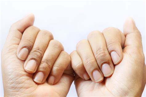 O czym świadczą bruzdy na paznokciach Jak je leczyć HelloZdrowie