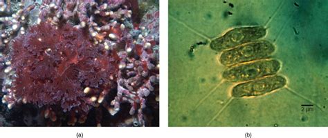We did not find results for: Biology, Biological Diversity, Protists, Eukaryotic ...