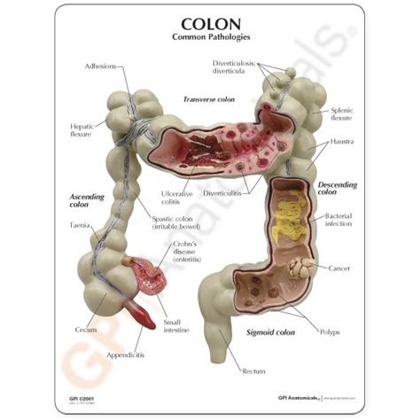 Anatomical Model Colon