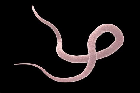 How To Deal With Roundworm Infection In Children Reviews Consult