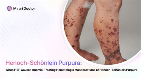 When Hsp Causes Anemia Treating Hematologic Manifestations Of Henoch