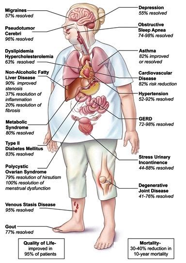 health risks of obesity smbc