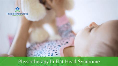 What Is Flat Head Syndrome Physiorehab Group