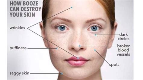 The Dehydration Caused By Boozing Accentuates Your Fine Lines And