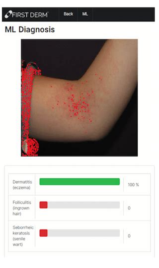 First Derms New Ai App Helps Users Identify Skin Conditions