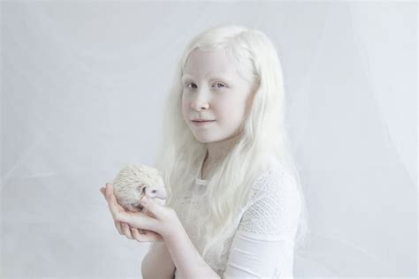 Yulia Taits S Porcelain Beauty Series Albinism Photographs Yulia Taits Part Popsugar