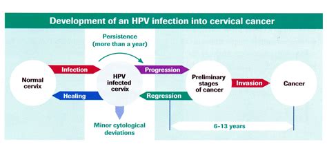 What Are The Risk Factors For Cervical Cancer Hpv Sali Hoe Foundation