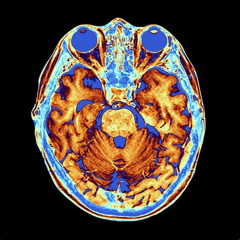 Coloured Mri Scan Of The Human Head Photograph By Alfred Pasieka