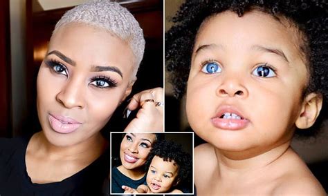 Mother And Her One Year Old Son Both Have Stunning Swirled Eyes That Are Blue And Black