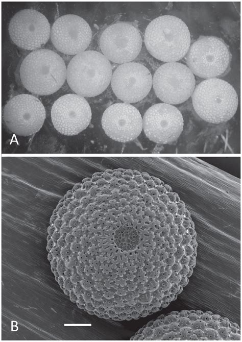 A Visually Apparent Size Differences In Eggs From A Dissected Female Download Scientific