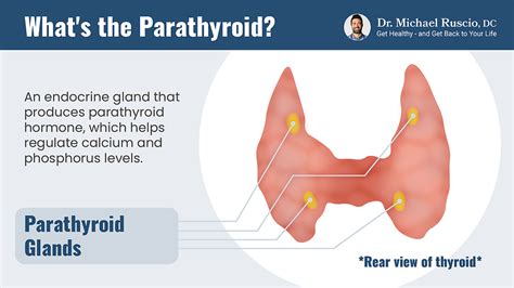 Hyperparathyroidism Symptoms Causes And Treatment Dr Michael