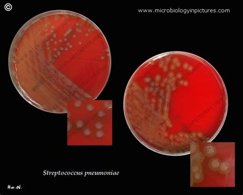 Virulent Strains Of Streptococcus Pneumoniae Pneumococcus On Blood