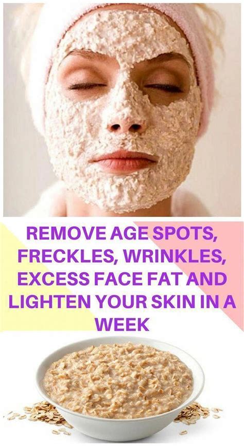 How To Naturally Remove Brown Spots On Face Home Remedies Age Spot Removal Natural Skin