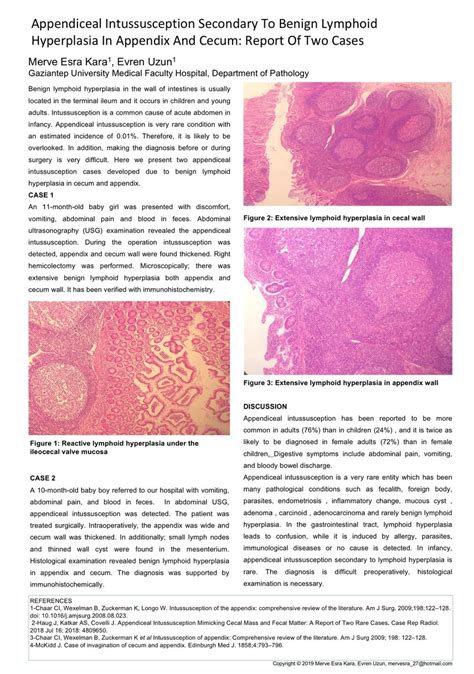 Pdf Appendiceal Intussusception Secondary To Benign Lymphoid