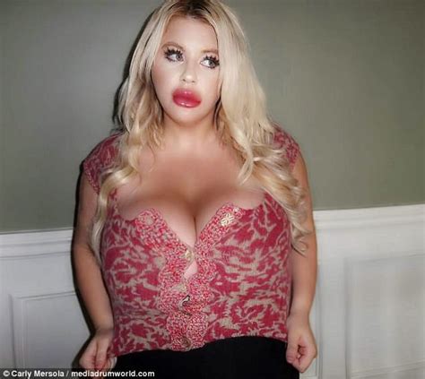 Woman Spends K On Plastic Surgery To Look Like Jessica Rabbit