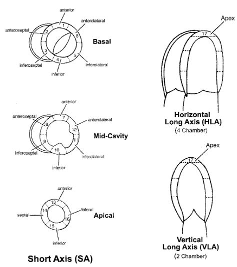 17 Segment Model Aha