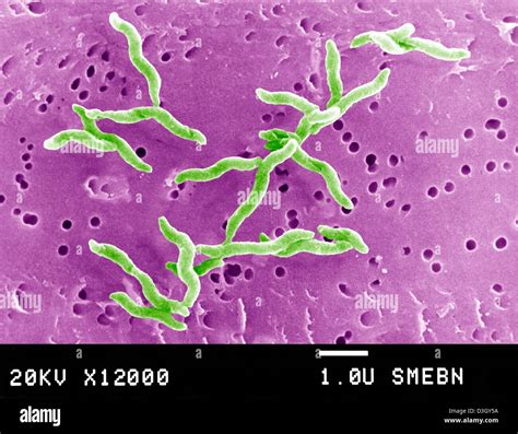 Bacteria Campylobacter Fotografías E Imágenes De Alta Resolución