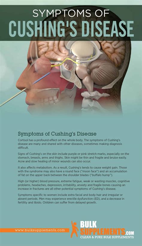 Tablo Read Cushings Disease Symptoms Causes And Treatment By