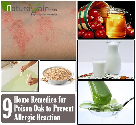 9 Best Home Remedies For Poison Oak To Prevent Allergic Reaction Home