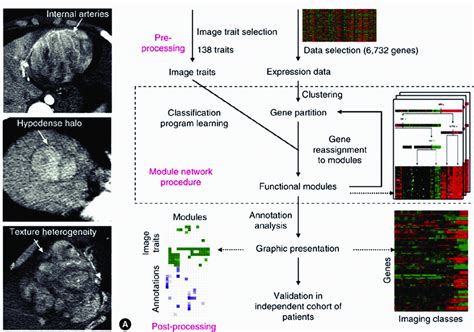 Imaging Traits Of Hepatocellular Carcinoma Hcc And Gene Expression