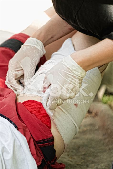 First Aid Procedure With Injured Leg Stock Photos