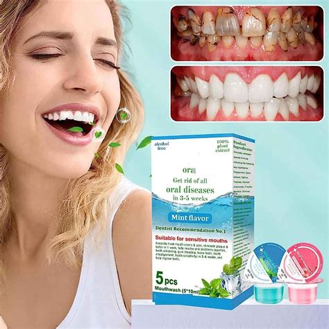 oralheal jelly cup mouthwash restoring teeth and mouth to health ebay