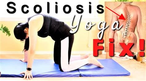 The Ins And Outs Of Scoliosis Yoga Treatment And Its Benefits Youtube In 2021 Yoga For
