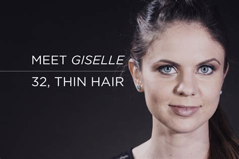 Hairatin Giselle And The Truth About Hair Loss In Women Hairatin®