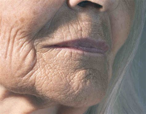 Guide To Facial Wrinkles Smoothed By Botox