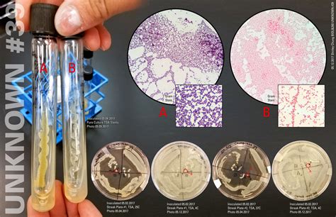 Microbiology Lab 9 Gram Stain Examples Basic Sciences