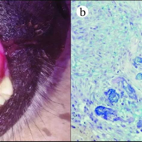 The Fourth Follow Up Time 4 Of A Dog With Oral Amelanotic Melanoma