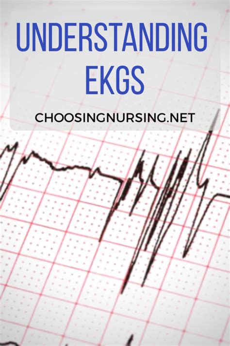 Understanding Nclex Ekg Rhythms Choosingnursing