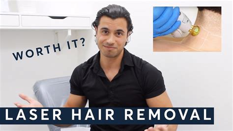 Laser Hair Removal For Men Worth It Youtube