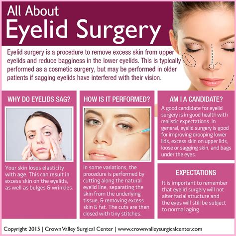 All About Eyelid Surgery Top Oc Surgery Center Crown Valley Surgical