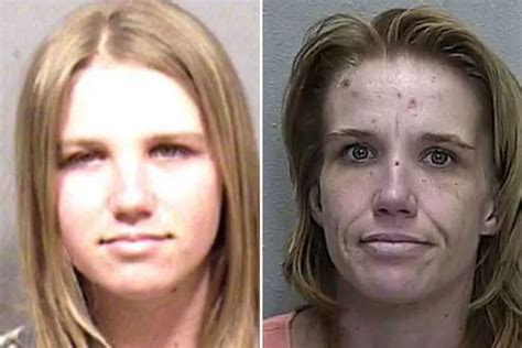 Meth Face Sores And Scabs What Meth Does To Your Skin