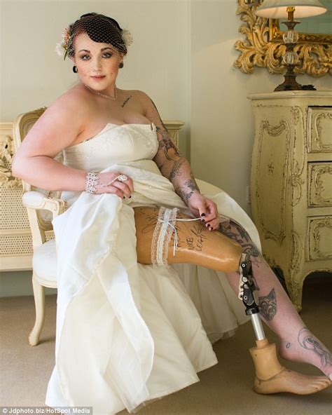 Amputee Called Peg Leg By School Bullies Conquers Her Insecurities To Become A Model Daily