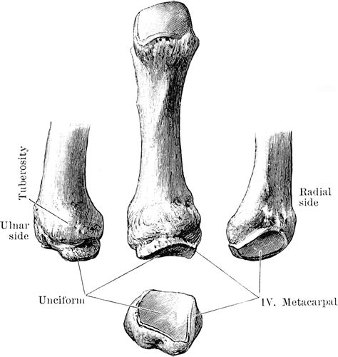 Fifth Metacarpal Bone Clipart Etc
