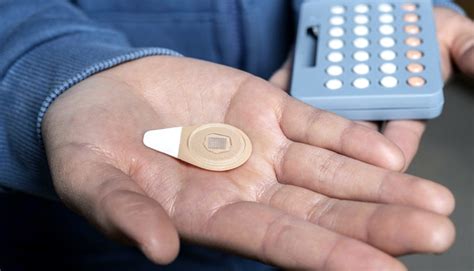 The Microneedle Contraceptive Patch • Knowledge Success