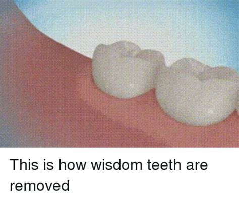 This Is How Wisdom Teeth Are Removed Meme On Me Me
