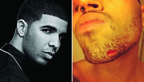 Chris Brown And Drake Feeling The Heat Of Night Club Brawl
