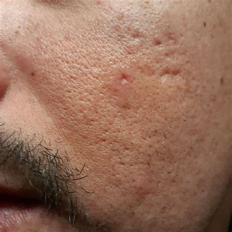 Collection Pictures Pictures Of Scars On Face Superb