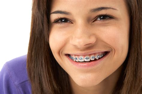 If it is the result of a dental procedure, call your dentist if the pain intensifies or persists for. how-to-get-rid-of-white-spots-on-teeth-after-braces