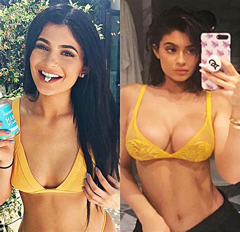 Did Kylie Jenner Get Breast Implants See Before And After Photos Hollywood Life