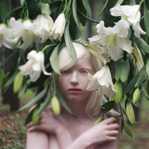 Nastya Zhidkova Albino Model Albino Girl Albino Human