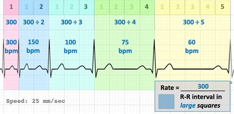 Autobiografie La Pachet Fundal How To Calculate Heart Rate From Ecg