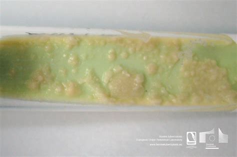 It contains malachite green, glycerol, asparagine, coagulated eggs. EURL Bovine tuberculosis Images Database