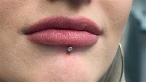 Lip Piercing And How To Get Rid Of Infected Lip Piercing