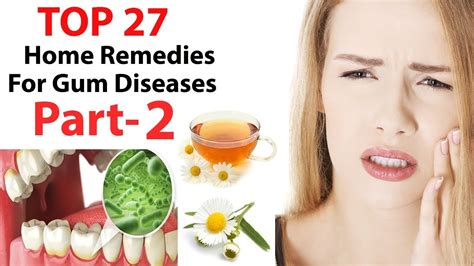 Gum Diseases Top 27 Useful Gum Disease Treatment And Home Remedies To